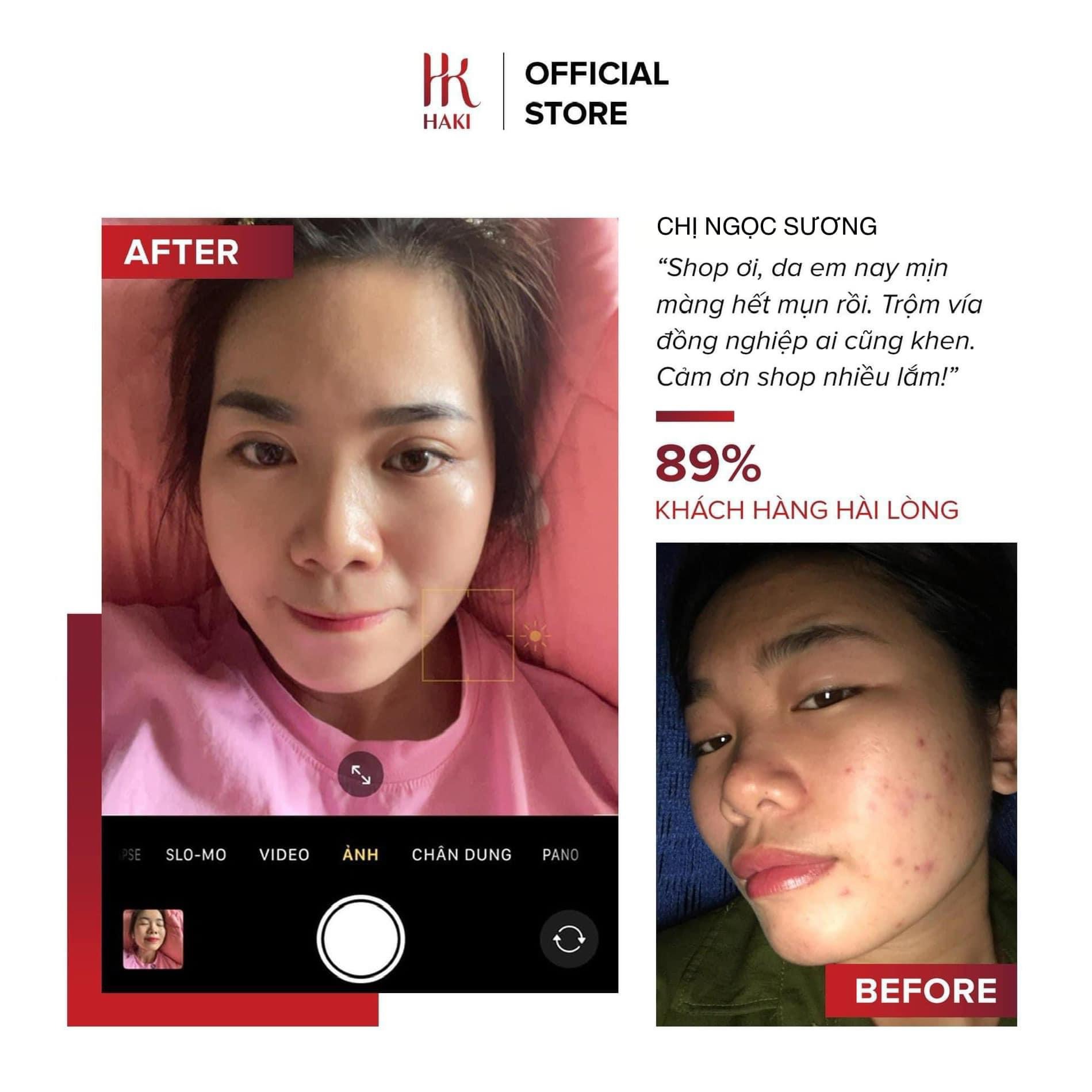 SERUM NGỪA MỤN HAKI GINGEM