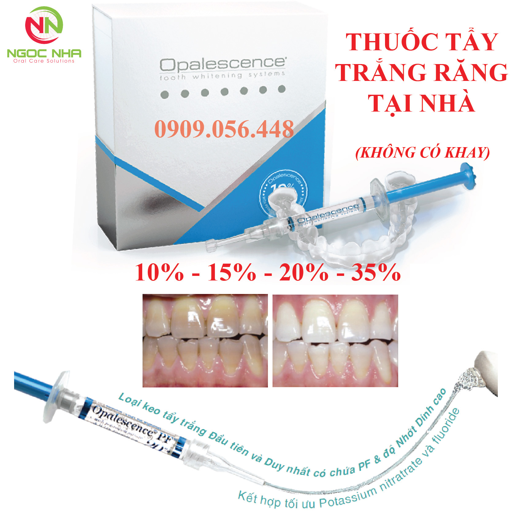 Gel tẩy trắng răng tại nhà Opalescence - có chứa PF  có tác dụng tẩy trắng răng, giảm ê buốt & giảm sâu răng, tuýp 1.2ml