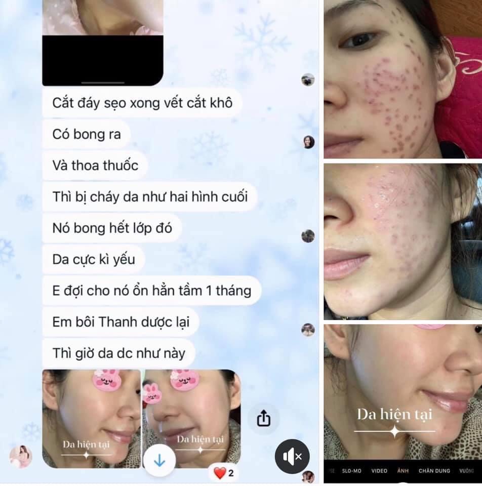 Serum Thanh Dược Lare chiết lẻ 10ml