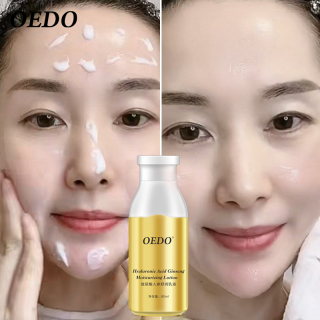 OEDO Kem dưỡng ẩm nhân sâm chứa Hyaluronic Acid chăm sóc da làm trắng điều mụn và kiểm soát dầu - INTL thumbnail