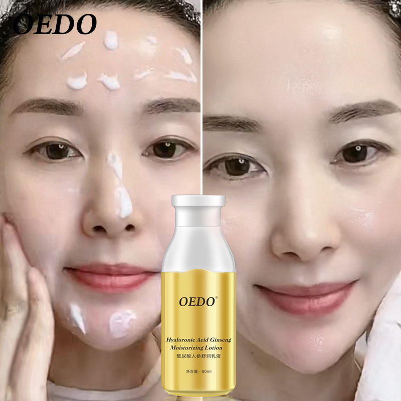 OEDO Kem dưỡng ẩm nhân sâm chứa Hyaluronic Acid chăm sóc da làm trắng điều mụn và kiểm soát dầu - INTL giá rẻ
