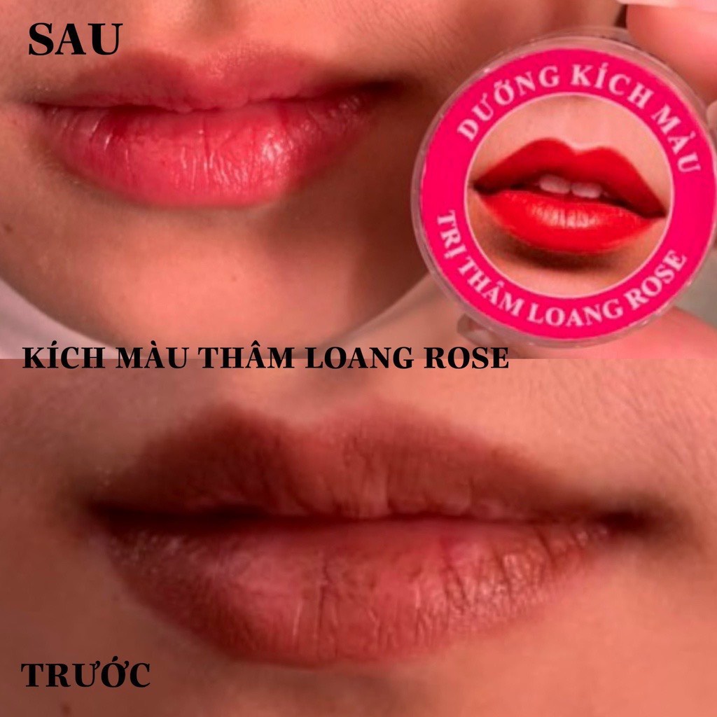 Dưỡng THÂM LOANG ROSE 10g