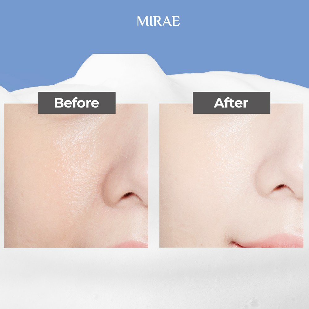 Sữa Rửa Mặt MIRAE làm sạch cấp ẩm hỗ trợ dưỡng da