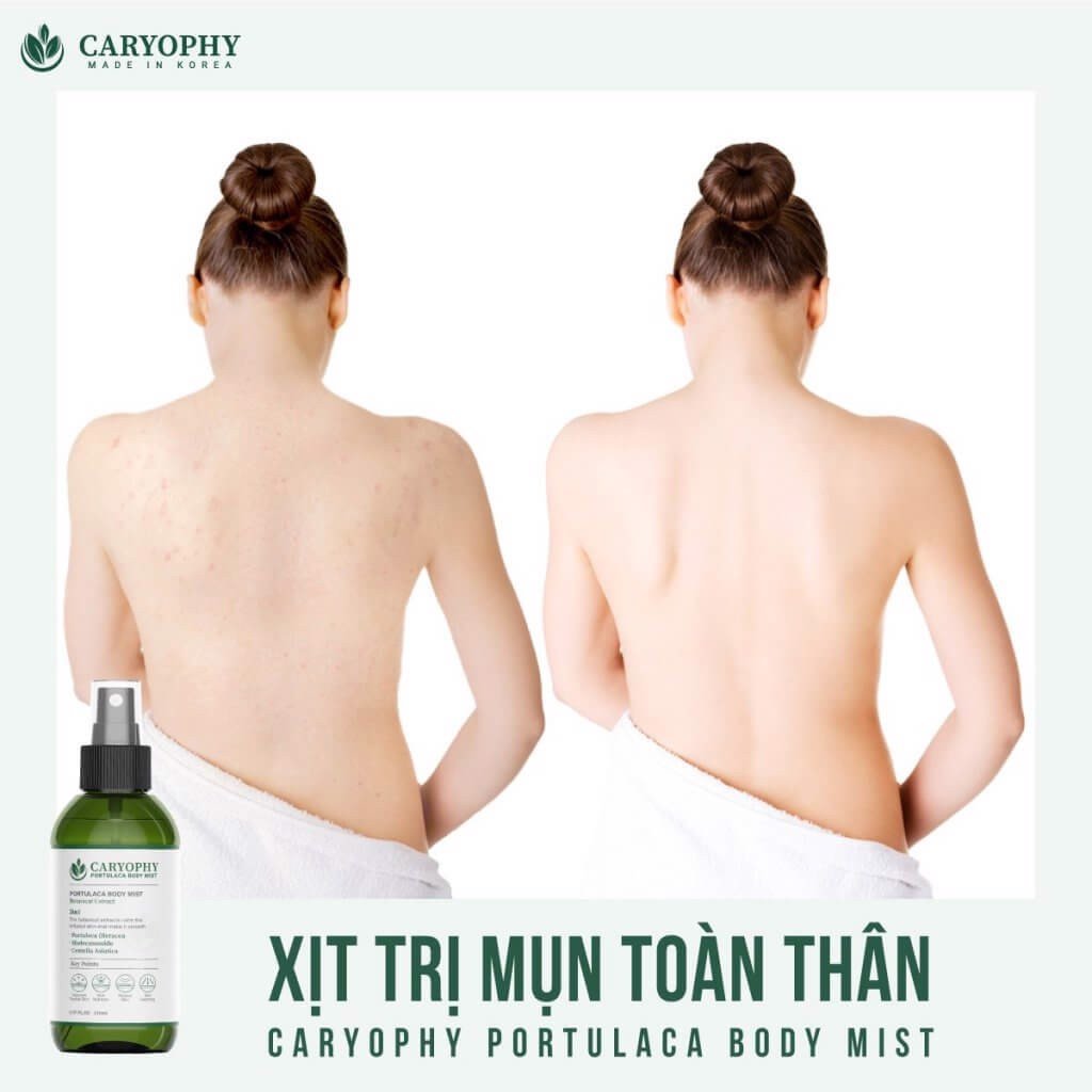 Xịt Mụn Lưng Caryophy Portulaca Body Mist 150ml