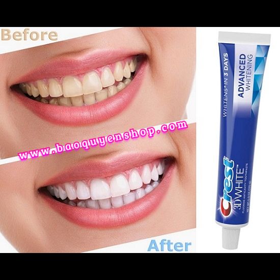 Kem đánh trắng răng Crest 3D White Vivid Mint Ultra 158g