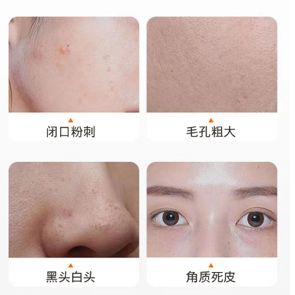 Mặt Nạ Sủi Bọt Tinh Chất Cà Rốt YANFU Gói 4ml