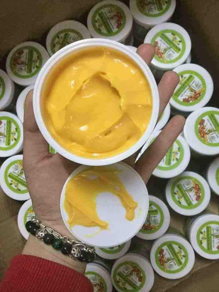[HCM]Kem tan mỡ gia truyền MPĐT