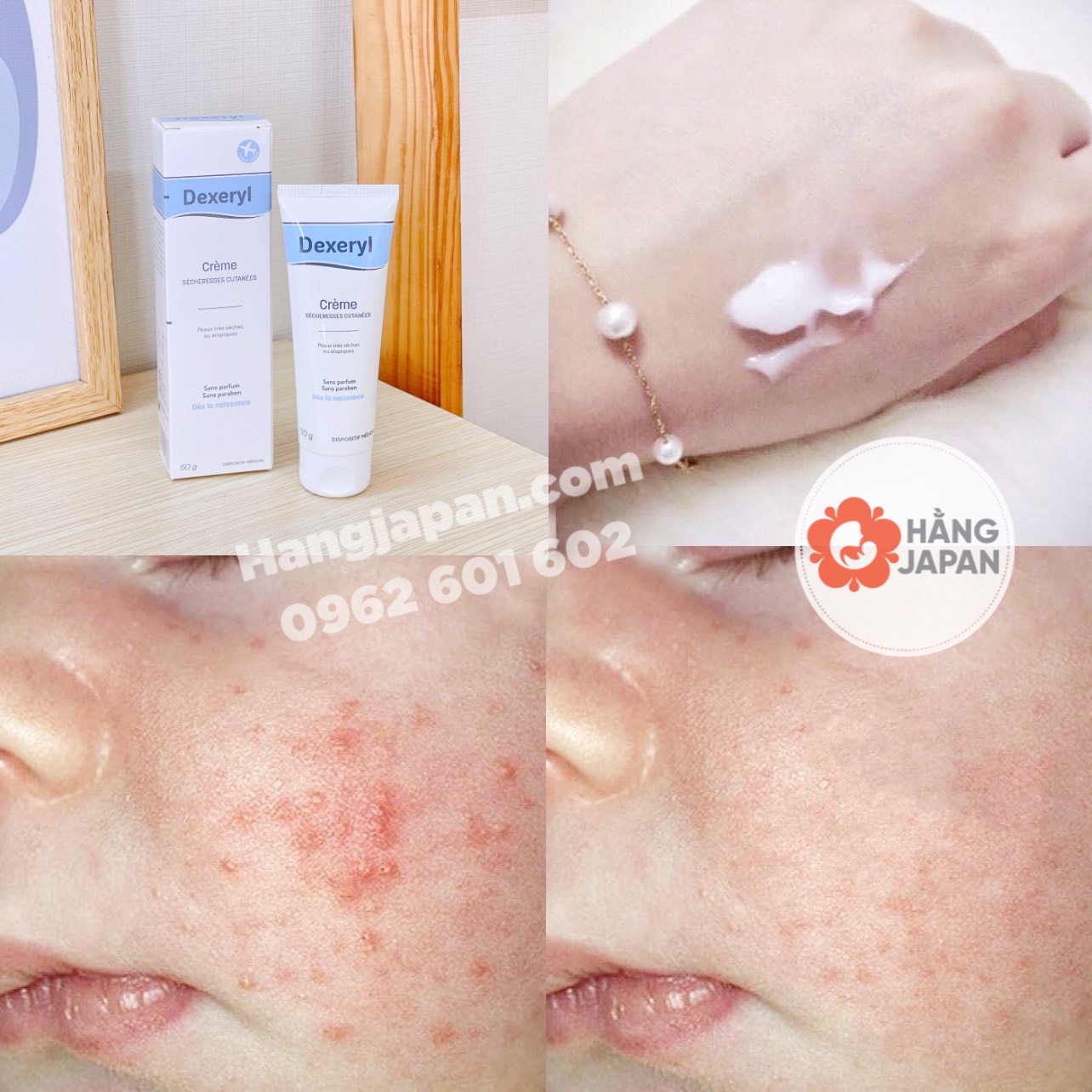 Kem dưỡng ẩm chống nẻ/chàm Dexeryl 50g - Hàng Pháp