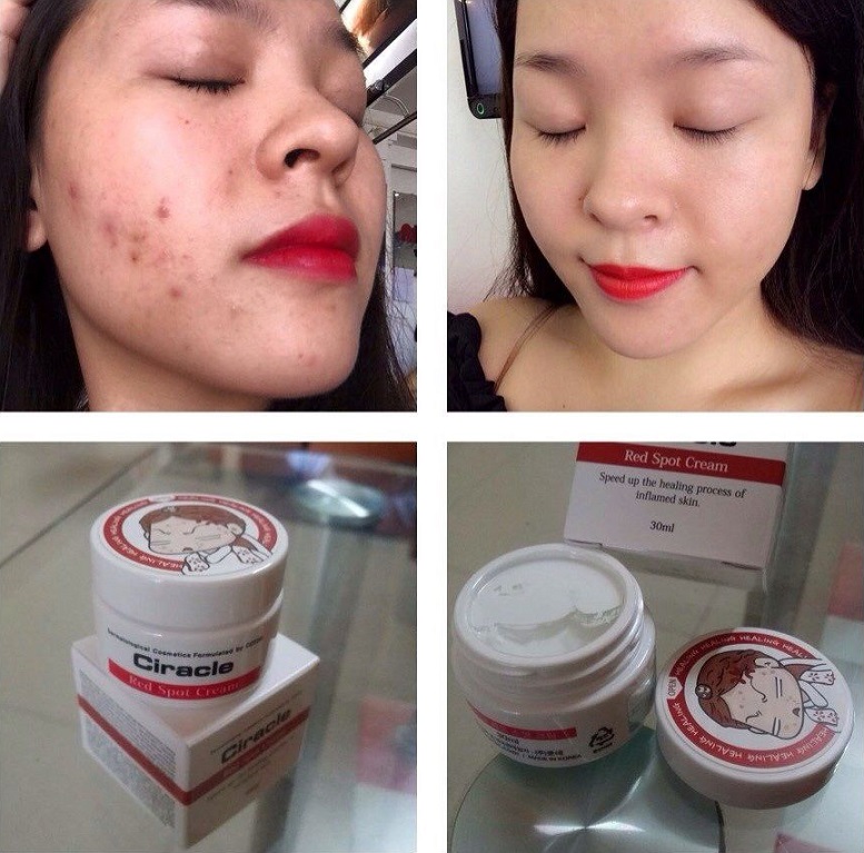 Kem Mụn Ciracle Red Spot Healing Cream 30g
