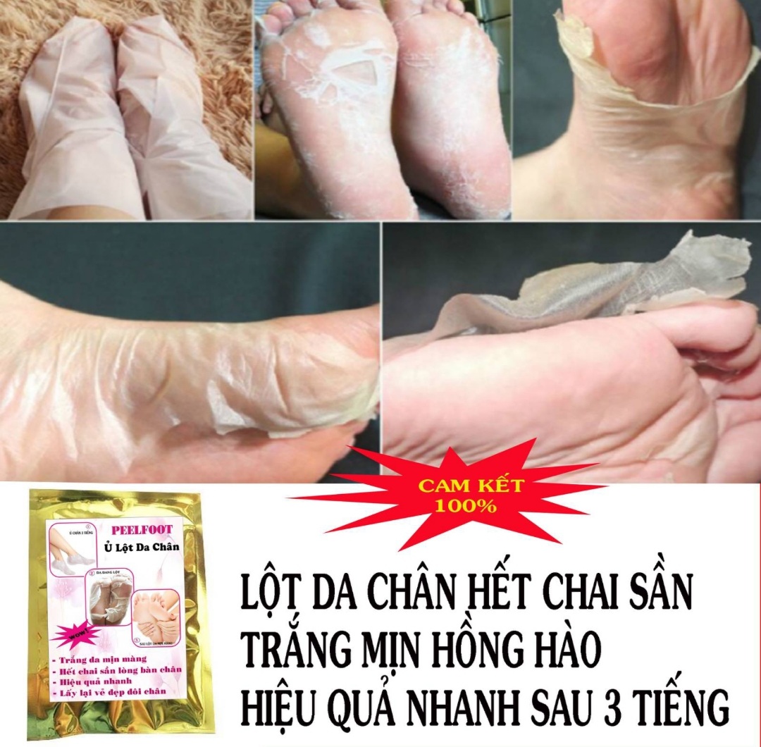 Ủ Lột Da Chân Trắng Mịn Hết Chai Sần nhám