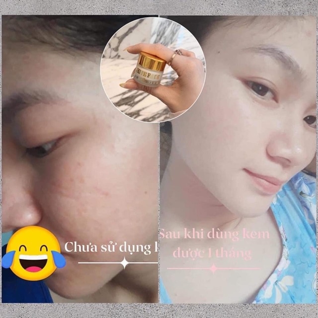 [HCM]Kem Face Trắng Da Hết Mụn Se Khích Lỗ Chân Lông Thái Lan