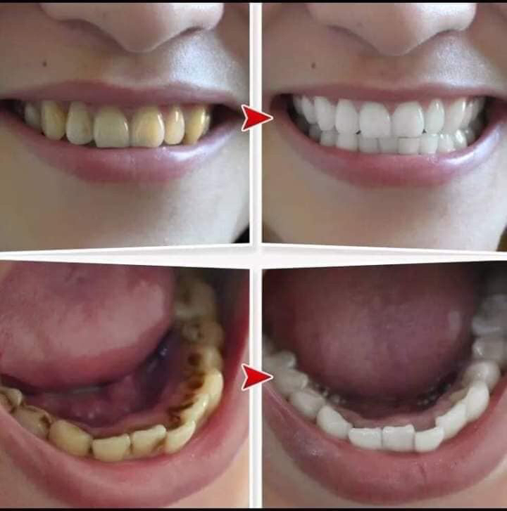 Bột than tre hoạt tính Zenpali