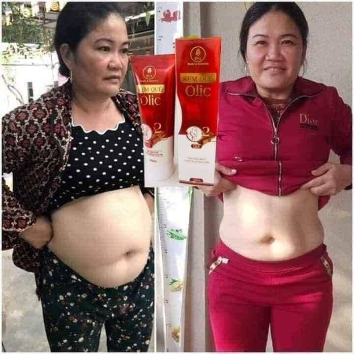 Tan Mỡ Olic Kem Quế Olic Tặng Thước dây