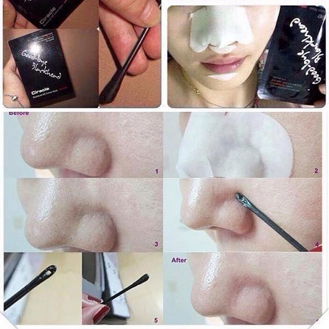 Hộp 20 miếng dán lột mụn Good Bye BlackHead Ciracle