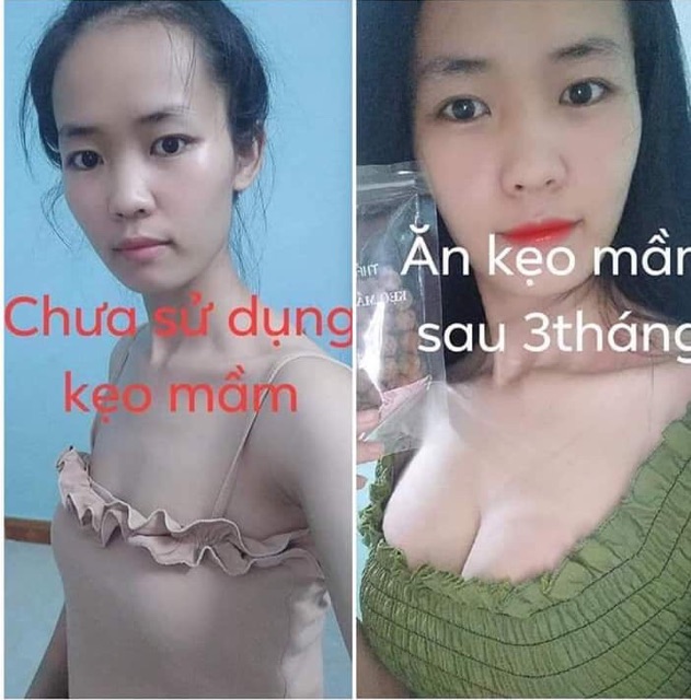 Kẹo mầm lúa mạch GOLD Thảo Mộc 37