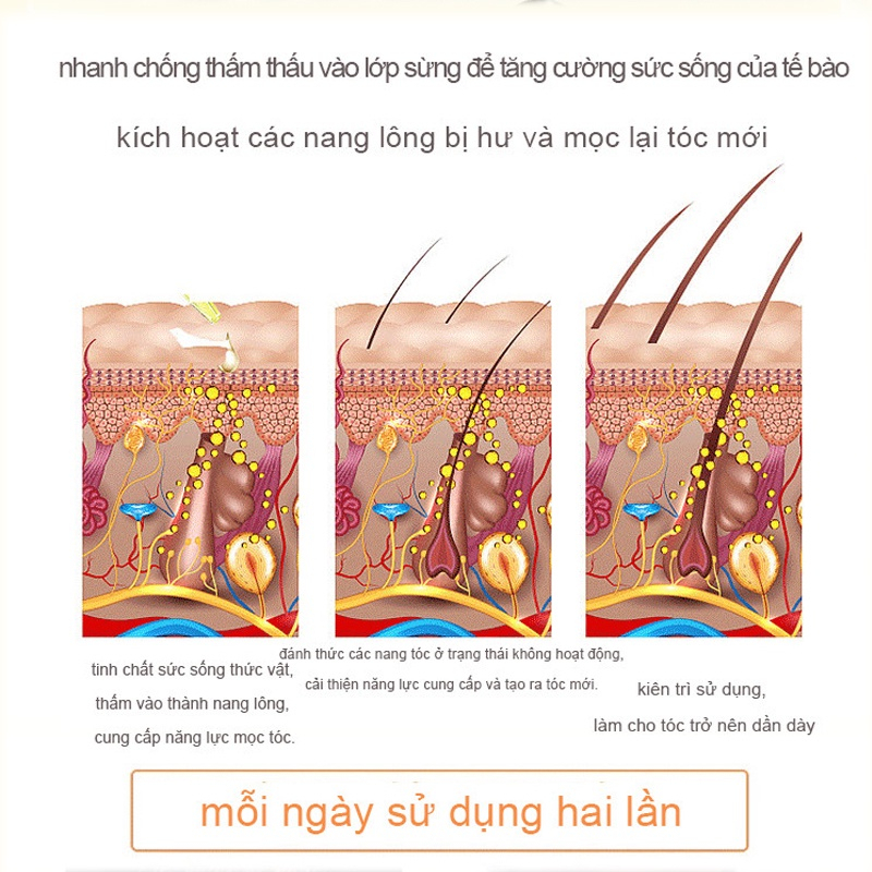 Thuốc mọc tóc serum kích mọc tóc chống rụng tóc kích mọc tóc chăm sóc tóc 30ml  kích thích mọc tóc nhanh làm dày