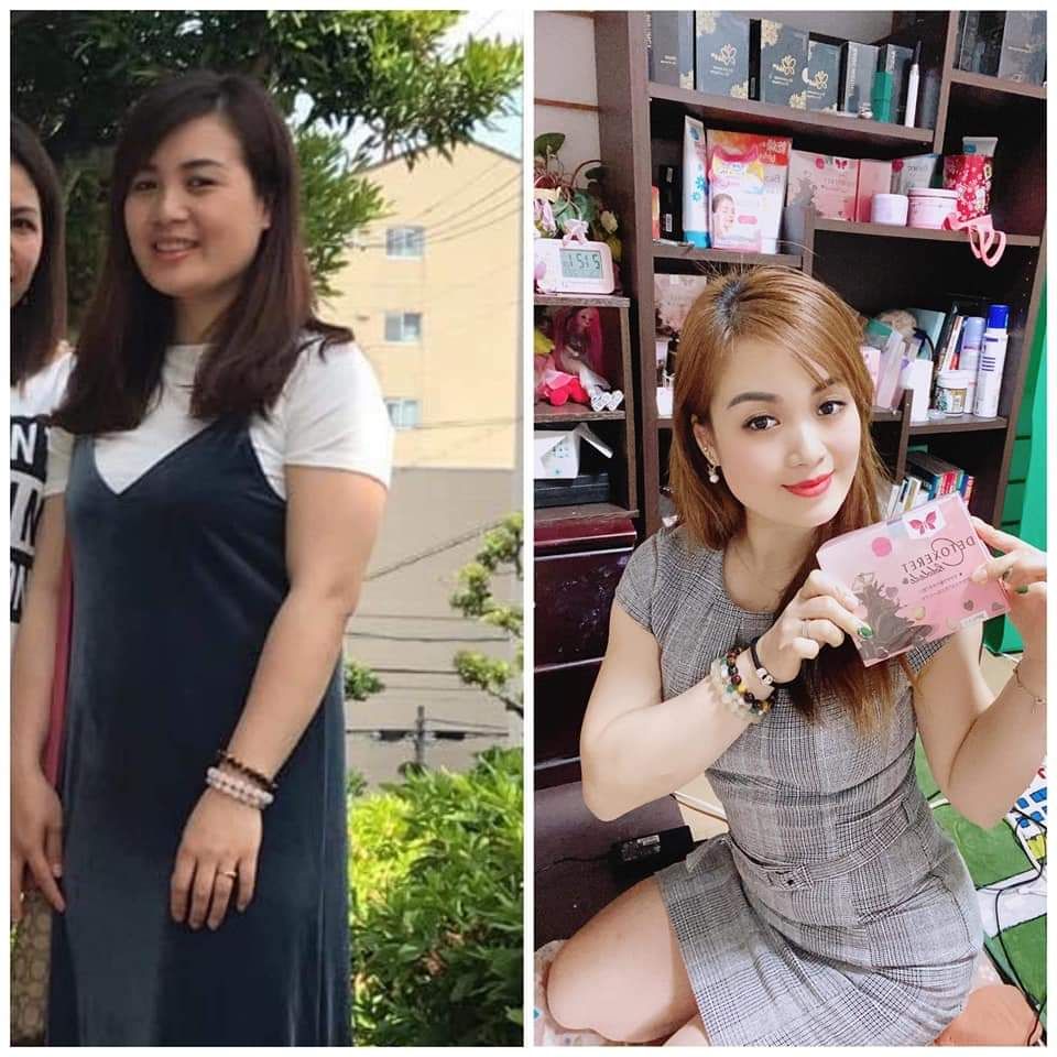 Giảm Cân Yoslim Yodetox của B.O T Combo Hủy Mỡ Cực Mạnh Hộp 30 viên