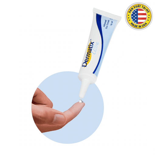 Dermatix Ultra – Kem Trị Sẹo 15g ®