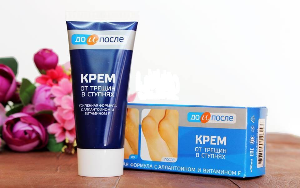Kem Cho Nứt Gót Chân Kpem Apteka Của Nga