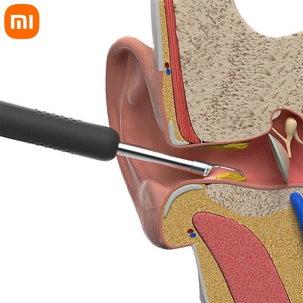 Tools remove ear wax endoscope Xiaomi bebird R1 tools remove ear wax machine suction earwax self động intelligent machine remove ear wax Xiaomi bebird R1 integrated portable endoscope 3.0 MPX tracking via app machine remove ear wax Xiaomi bebird R1