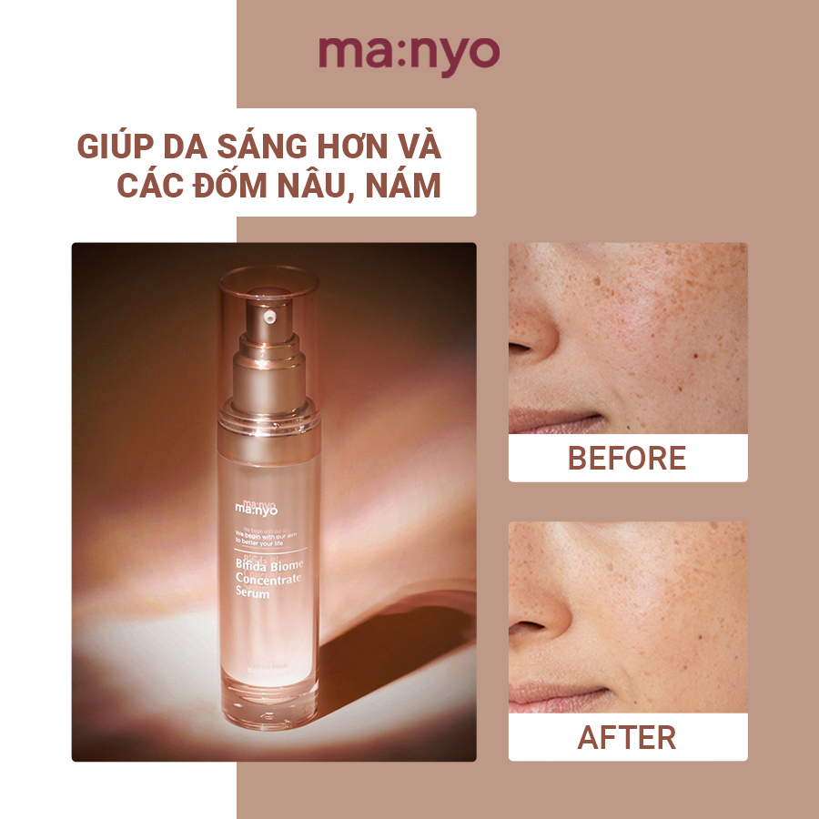 Tinh Chất Trẻ Hoá Da Manyo BIFIDA BIOME CONCENTRATE SERUM 35ml