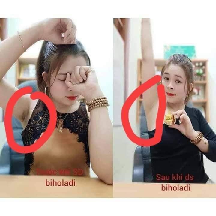siêu dưỡng thâm vùng nách bụng bikini biholadi5s