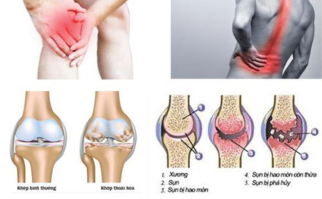 [HCM]Viên Bổ Khớp Atomy