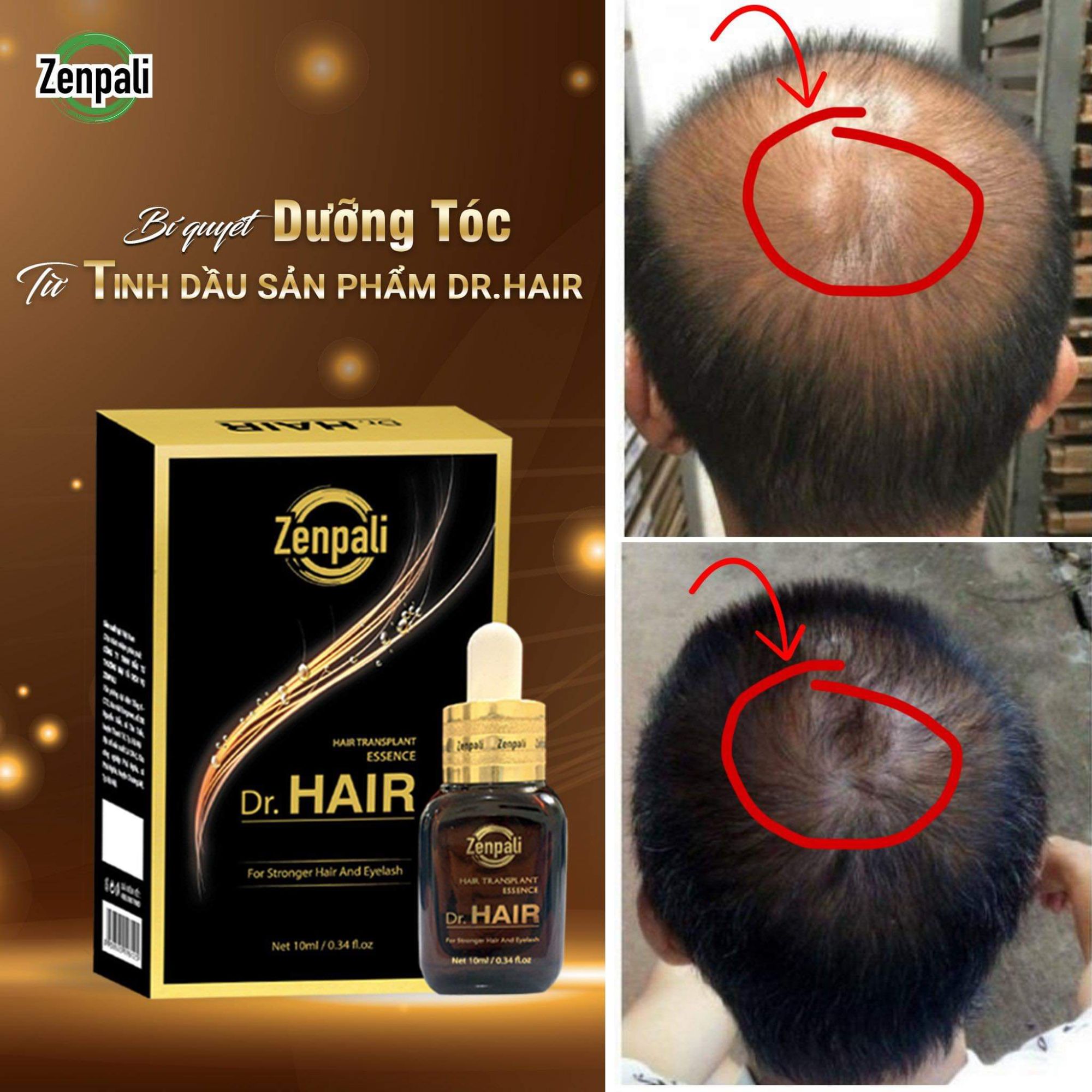 [HCM][CAM KẾT CHÍNH HÃNG] Tinh Chất Dài Mi Mọc Tóc Dr Hair Zenpali - MIPHAR2