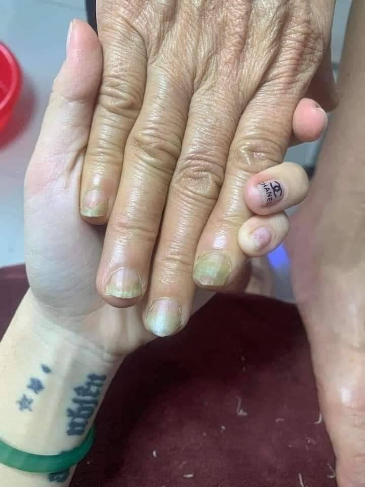 Serum Loại Bỏ Nấm Móng Varisi Restore Problem Nails