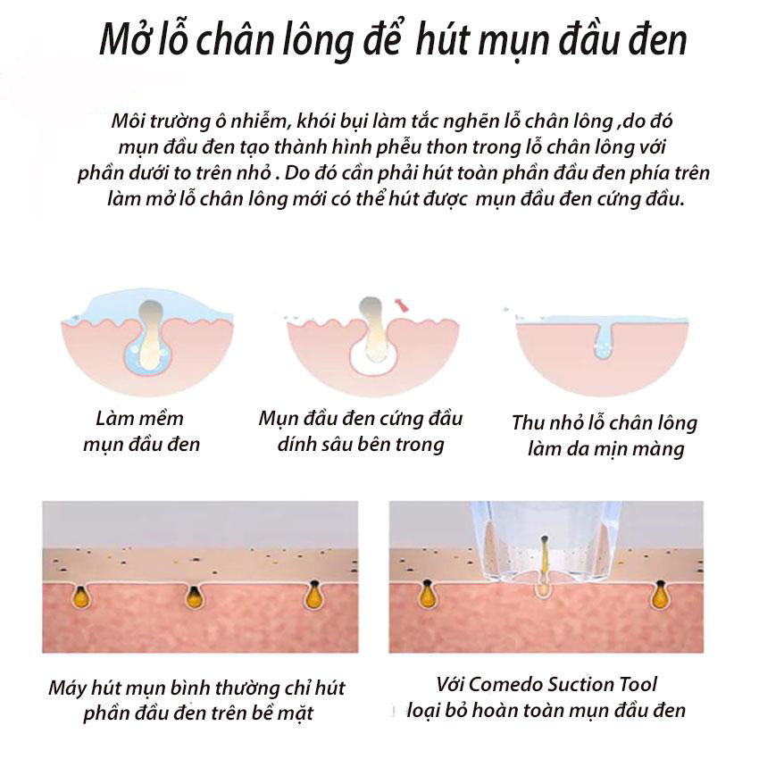 Máy Massage Mặt Bằng ION Cầm Tay