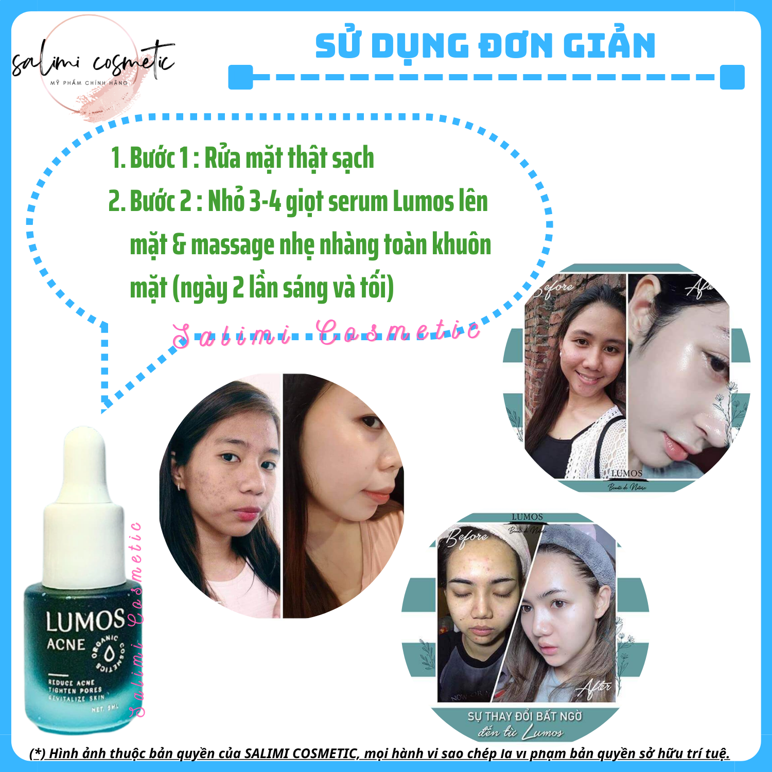 Serum acne Lumos acne | capacity 5 ml-genuine goods