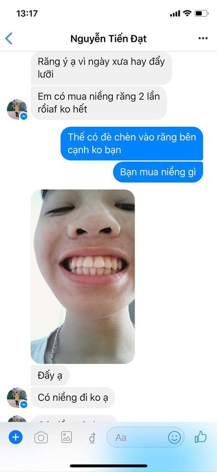 [HCM]DỤNG CỤ NIỀNG RĂNG [[ Dùng cho người lớn ]]( A1 + A2 +A3)