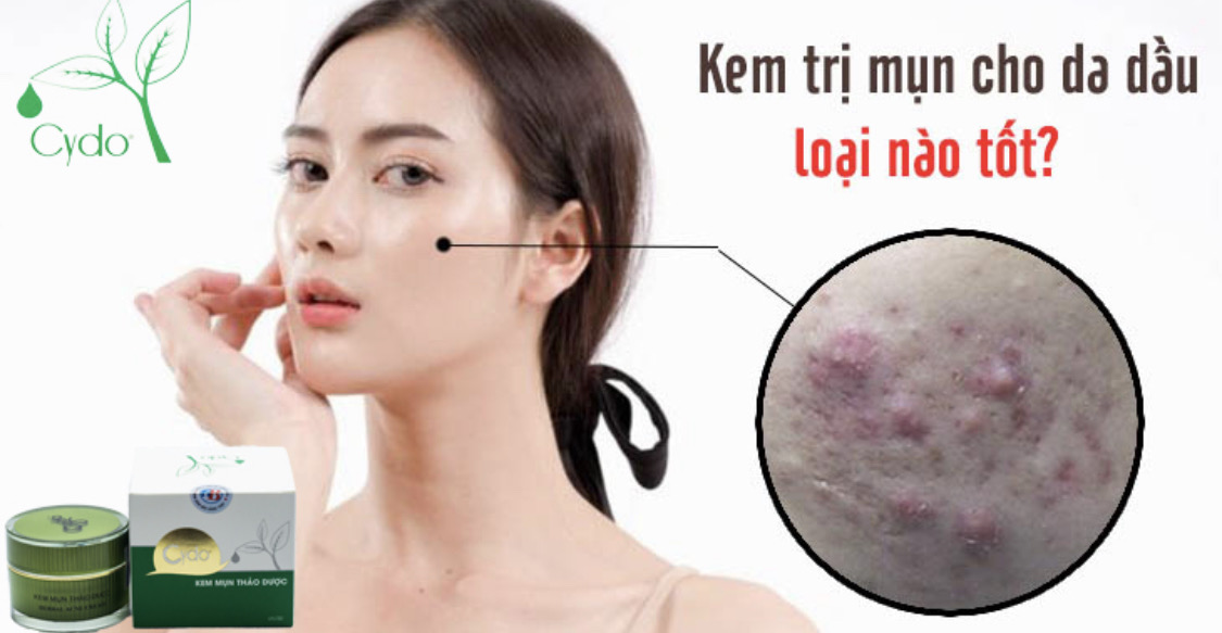 KEM MỤN THẢO DƯỢC CYDO