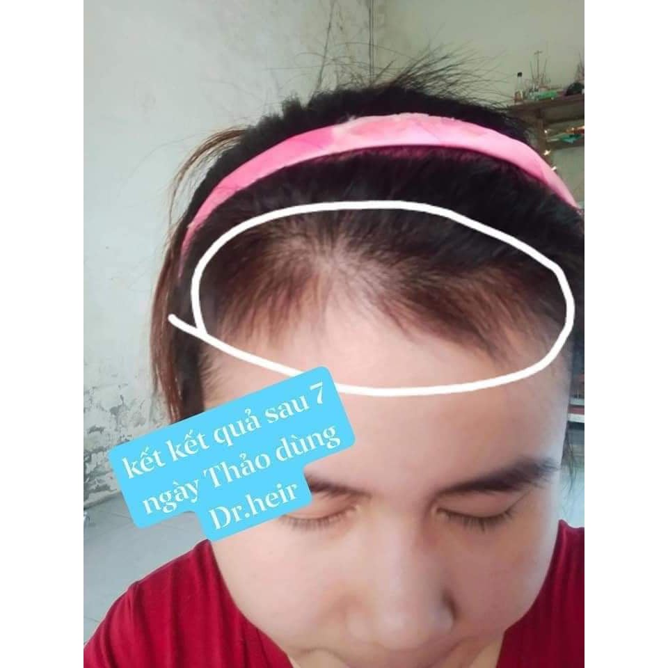 [CHÍNH HÃNG] Tinh Chất Dài Mi Mọc Tóc Dr Hair Zenpali 10ml