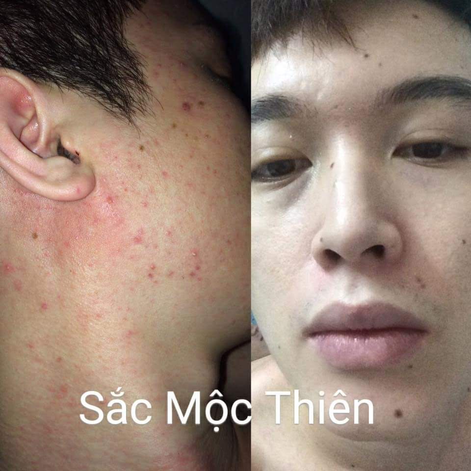 Sắc Mộc Thiên Cao Cấp 30ml