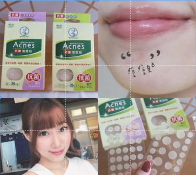 Míếng dán mụn Mentholatum Acnes từ Đài Loan