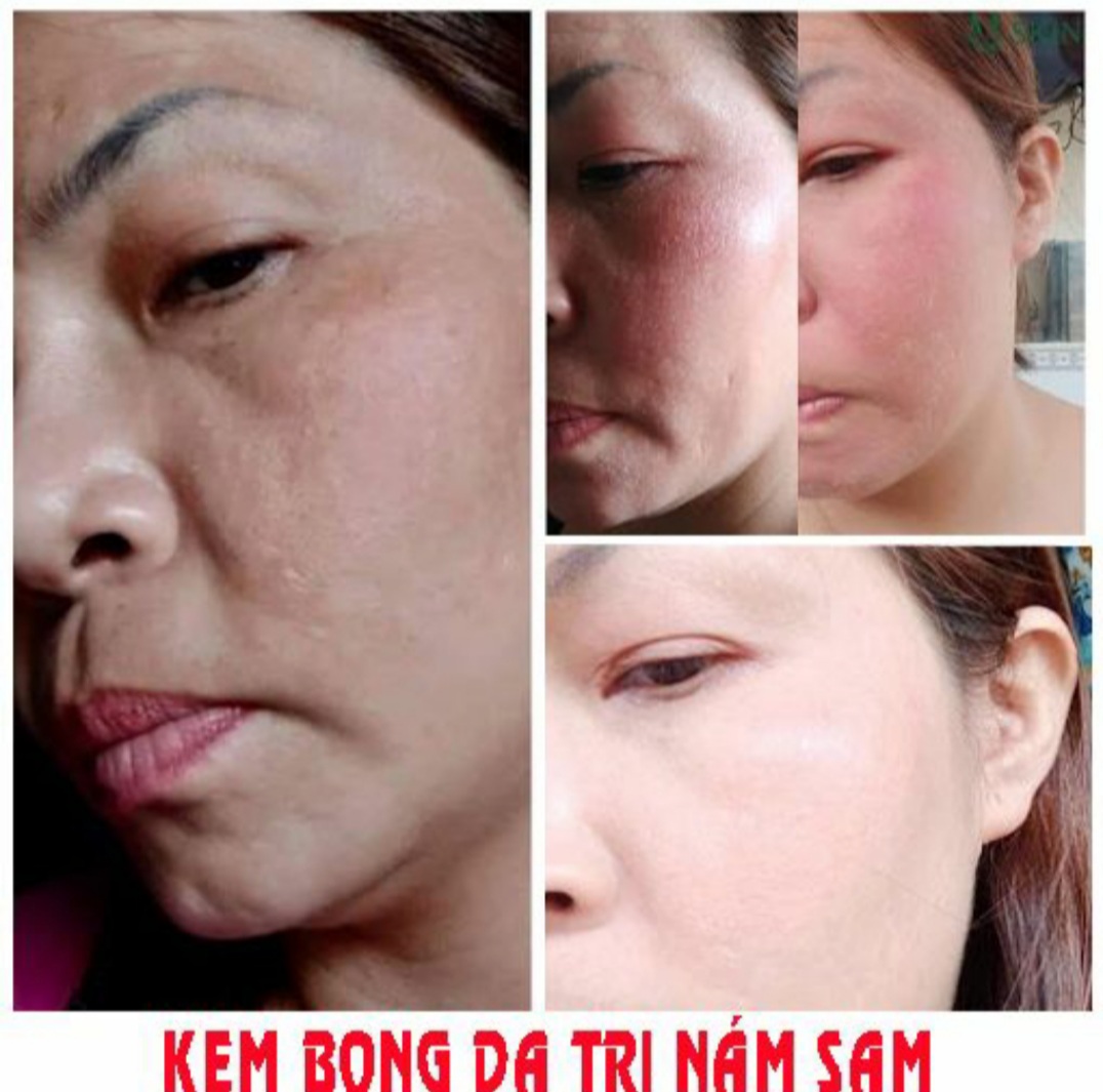 [HCM]Kem vỗ bong da mặt BEZY ThaiLan