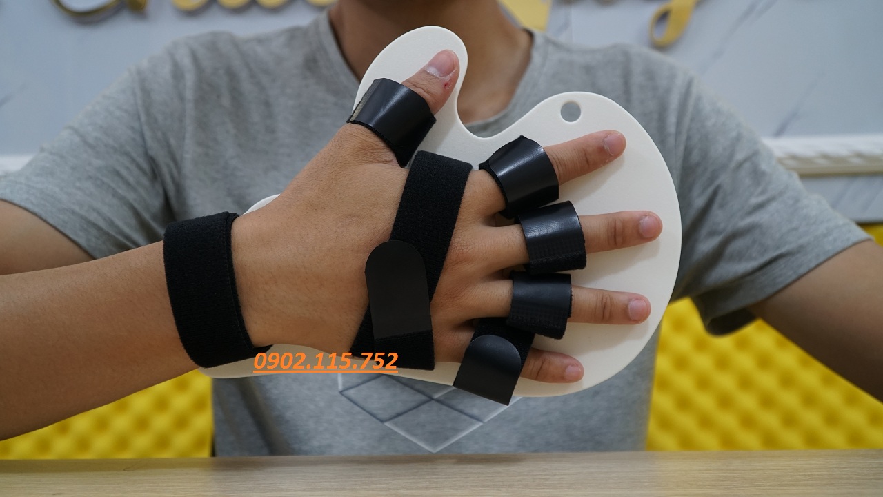 NẸP CỐ ĐỊNH BÀN NGÓN TAY