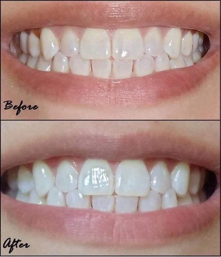 Bột Tẩy Trắng Răng Eucryl Toothpowder Freshmint