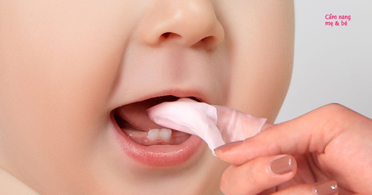 Gạc rơ lưỡi y tế trẻ em Tanaphar đã tiệt trùng [HỘP 50 CHIẾC]