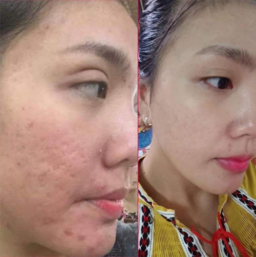 Gel Kỳ Da Chết Cà Phê Cao Cấp - Mẫu mới