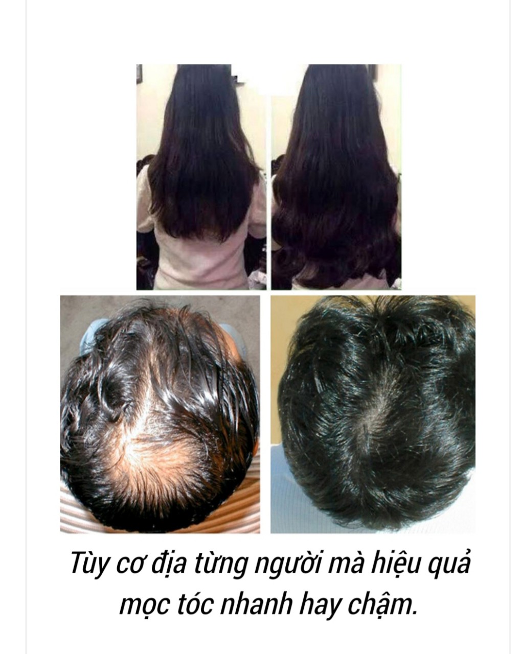 [HCM]Dầu Gội Chống Rụng Tóc Biotin Collagen 385ml