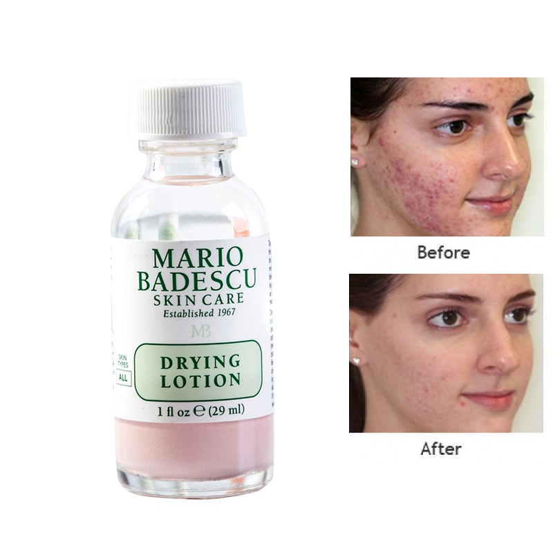 [29ml + Bill] Chấm Mụn Mario Badescu Drying Lotion