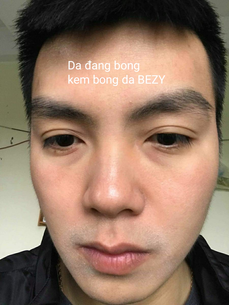 Kem BEZY Bong Da Mặt Xóa Thâm Nám Sạm Trắng Da ( Bong nhanh sau 5 ngày)