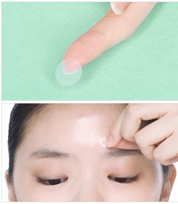 Combo 5 Miếng Dán Mụn Somaderm 12 ( Hộp 12 Miếng)