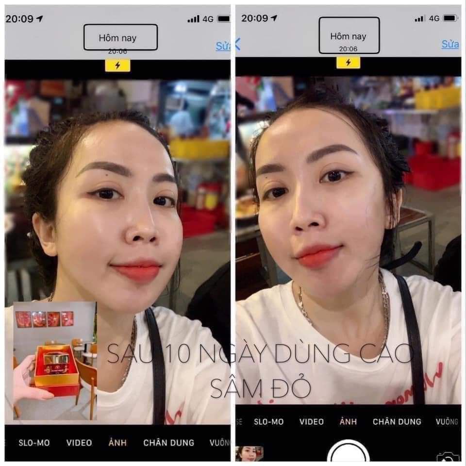 [HCM]CAO MỤN SÂM ĐỎ ( HỦ LỚN 15G)