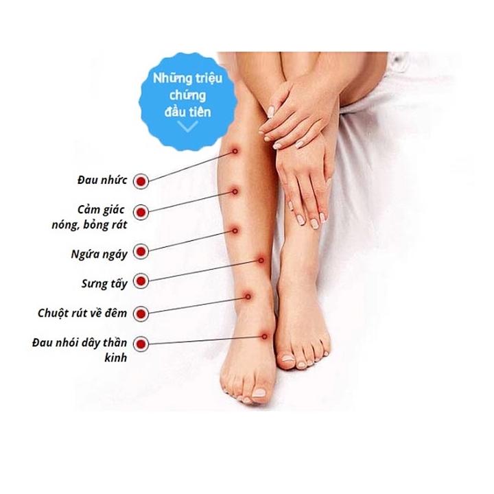 Kem Trị Suy Giãn Tĩnh Mạch Varikosette Nga 75ml