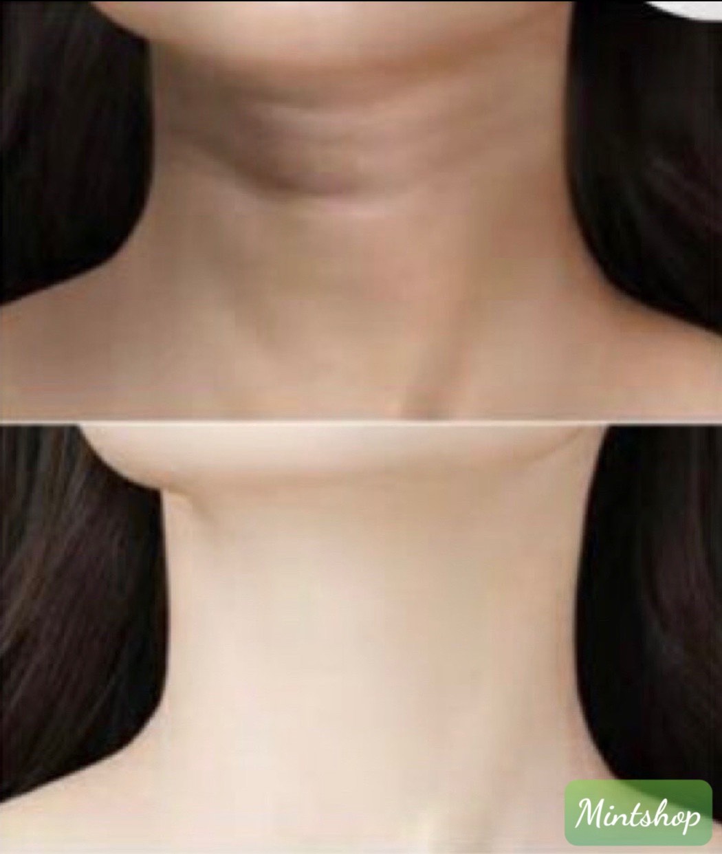 [HCM]LUCENBASE Thanh Lăn Cổ Làm Trắng
