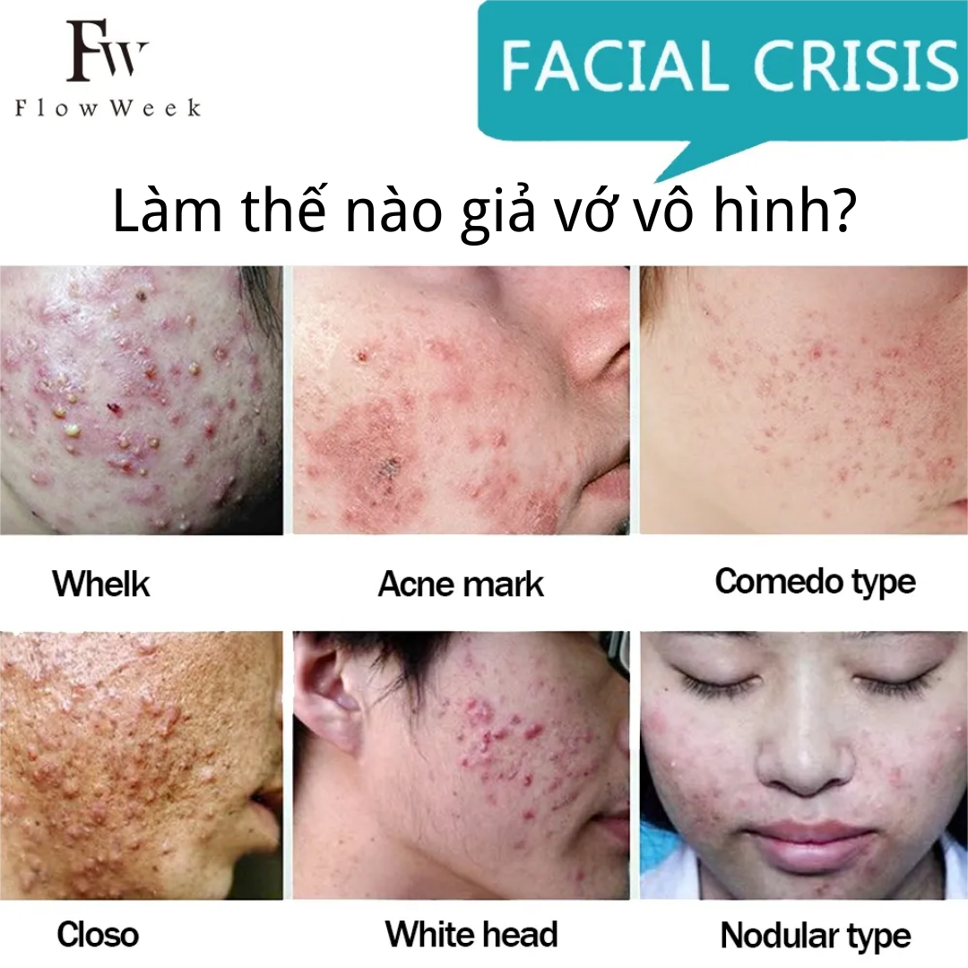 Flow Week Miếng dán trị mụn Miếng dán trị mụn Hydrocolloid Miếng dán trị mụn không thấm nước Miếng dán trị mụn Hydrocolloid Miếng dán trị mụn vô hình thoáng khí Miếng dán chống mụn trên mặt