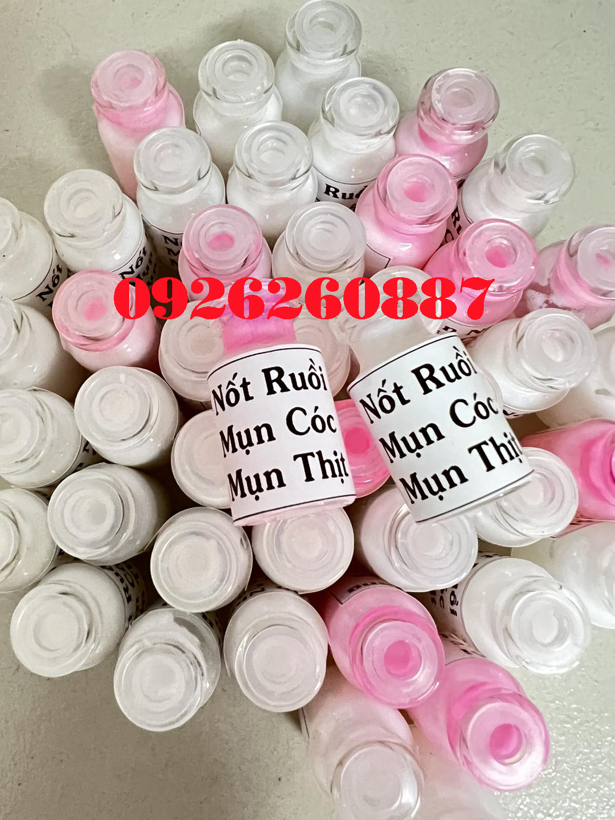 Tẩy Nốt Ruồi Tàn Nhang, Mắc Cá,Mụn Thịt, Mụn Cóc